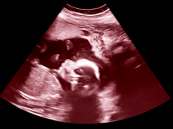 The Truth About&nbsp;Pregnancy